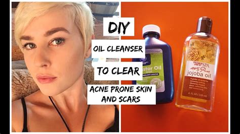 Got it, ready for a recipe! EASY DIY Acne Clearing Cleansing Oil - YouTube