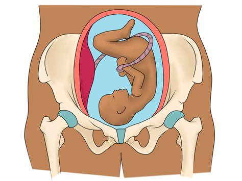 Approved by the babycenter india medical advisory board. SPD & PGP: Symphysis Pubis Dysfunction & Pelvic Girdle ...