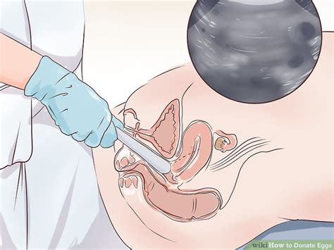 Apply to become an egg donor with myeggbank. How to Donate Eggs (with Pictures) - wikiHow