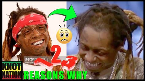Babies often lose their hair during the first six months of life. 3 Reasons Why Lil Wayne has Bald Dreadlocks - YouTube