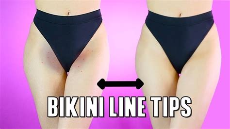 Buy a beard or hair trimmer and trim the pubic area to the desired length take a hot shower. Bikini Line 101 | Get Rid of Dark Spots, Ingrown Hair, and ...