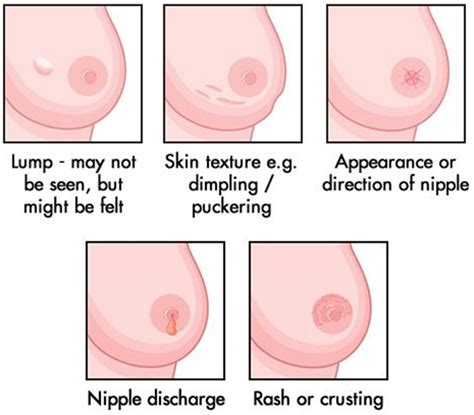 Unless people experience breast cancer in their own here at breastcancer.org, we run into some of the same myths year after year. 'Pain is not an early sign of breast cancer' - Rediff.com ...