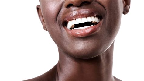 Upon hearing the dreaded words, you need a root canal, my heart dropped to my toes. How To Know if You Need a Filling or a Root Canal