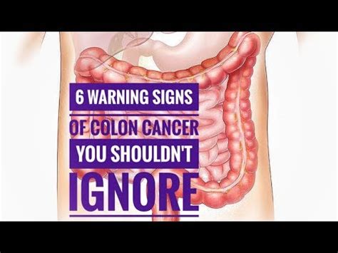 Although some changes are normal and expected, others might be a sign of disease, such as cancer. 6 signs and symptoms of Colon cancer you should not ignore ...