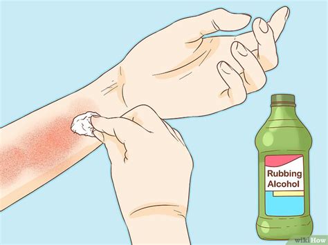 Poison oak) in kontakt kommt, kann das einen juckenden. Ausschlag von Giftefeu oder Gifteiche behandeln - wikiHow