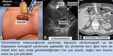 Hamilelikte rahim ağrısı nedenleri ve tedavisi. Pankreasın Görevi ve Özellikleri - pankreas.gen.tr