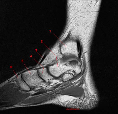 2 muscle layers superficial layer: MRI of the Ankle: Detailed Anatomy - W-Radiology