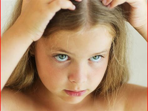 Experts speculate that this rapid conversion of testosterone to dht may be what causes continued hair loss in patients whose thyroid problems are otherwise controlled by medication. Causes of Hair Losses in Teenage Males - Best Kids Hairstyle