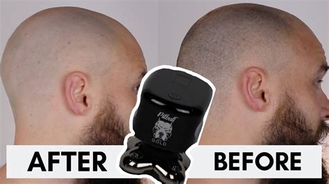 Maybe you would like to learn more about one of these? SKULL SHAVER HEAD SHAVE - *Pitbull Gold review - YouTube