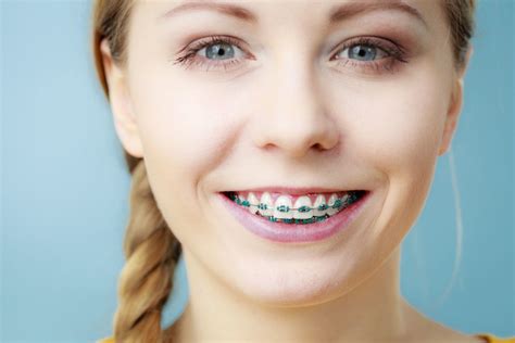 Orthodontics for Teens | Braces Canton | Invisalign Canton