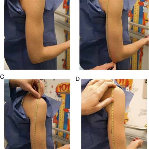 Blood pressure is not always consistent, and can vary even when the child is resting. Determination of proper BP cuff size. 95 A, Marking spine ...