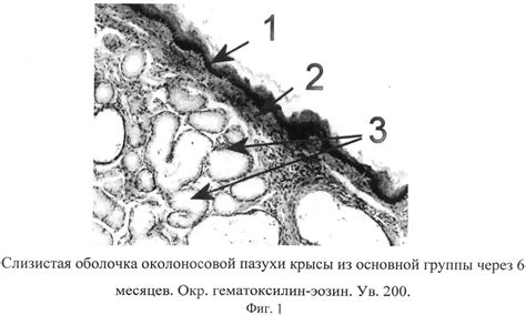 We did not find results for: способ экспериментального моделирования воспаления в ...