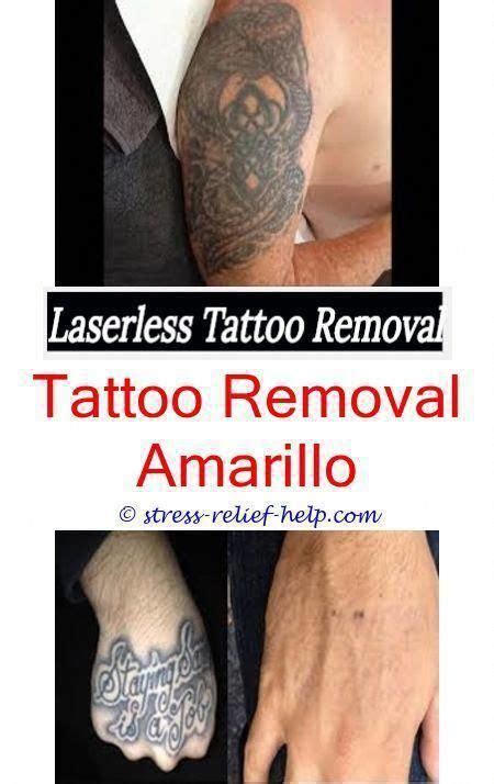 In most cases, healthier clients require fewer sessions to remove their tattoos. tattoo goo can laser hair removal affect tattoo - how to ...