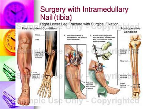 PPT - 7.Knee injury ( Diagnosis???) PowerPoint ...