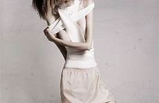 anorexic heroin anorexia