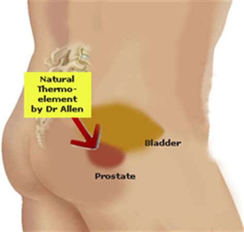 Any man experiencing chronic nonbacterial prostatitis, should take a hard look at his diet and lifestyle and take steps to decrease his inflammatory loading. Dr. Allen's Device Cures BPH and Chronic Prostatitis while ...