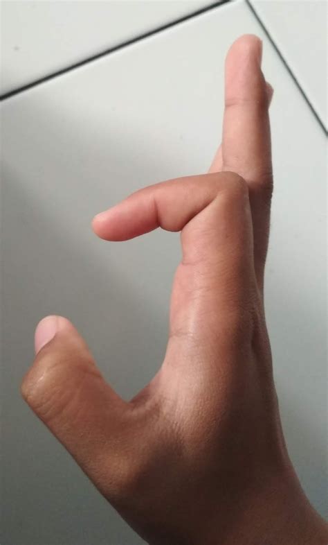 Selain rematik ada beberapa penyakit lain yang lebih sering mengakibatkan nyeri sendi di daerah tangan ketimbang penyakit rematik, yakni penyakit trigger finger, carpal tunnel syndrome, dan penyakit de quervain. Mimilesson: Ragam gerak tari jawa