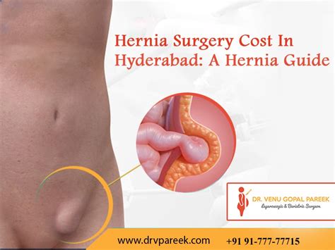 If you are uninsured, or have a high deductible, then you. Hernia Surgery Cost In Hyderabad: A Hernia Guide