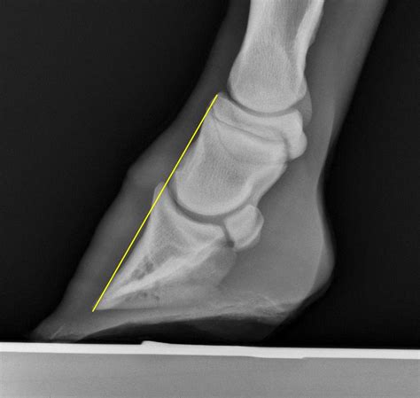 If it comes back, some of the treatment stages may need to be repeated. Michael Porter, Equine Veterinarian: Club foot!!