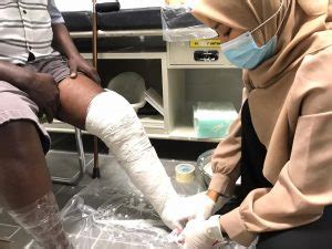 .patellar tendon bearing (ptb) cast 29440 adding walker to previously applied cast 29445 application of rigid total of clubfoot cast with molding or manipulation, long or short leg. Casting for Patellar Tendon Bearing Ankle Foot Orthosis ...