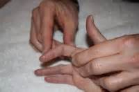 Bunnell-Littler Test - Physiopedia