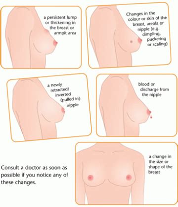 As the tumor grows, a person may be experts do not know exactly why breast cancer develops, but the following risk factorstrusted source get our newsletter. Tumore della mammella: terapia differente tra donne ...
