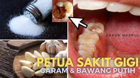 sakit gigi togel
