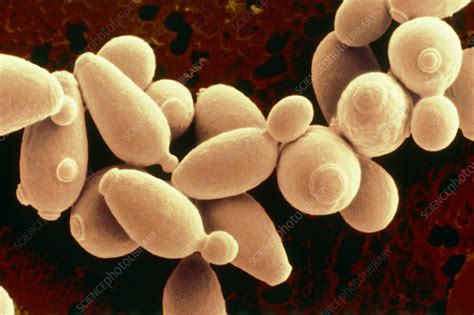 In yeast cells, budding starts with the softening of a small portion of the cell wall. Yeast cells - Stock Image - B250/1029 - Science Photo Library