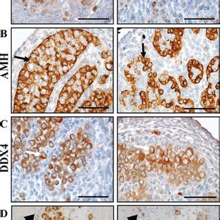 However, it is important to bear in mind that they are not always that specific. Cell-specific markers of somatic and germ cell lineages ...