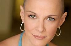 women bald beautiful google ca