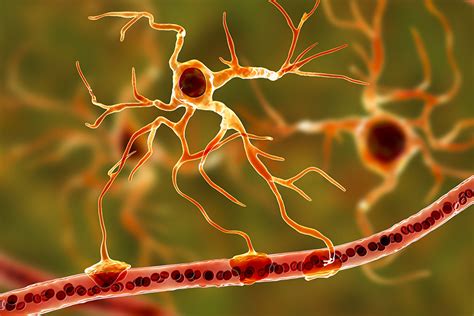 La esclerosis lateral amiotrófica (ela) es la enfermedad de la neurona motora (enm) más común. Nuevas estructuras moleculares asociadas a la enfermedad ...