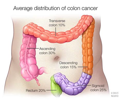 Most colorectal cancers are due to old age and lifestyle factors, with only a small number of cases due to underlying. Prevalence Of IBD Cases Among Children | The Local Brand®