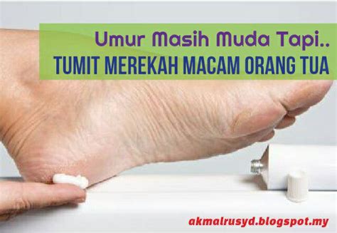 Terjadinya tumit kaki merekah dan kering kerana kaki adalah salah satu bahagian tubuh yang sangat mudah kering. Umur Masih Muda Tapi Tumit Merekah Dan Pecah Macam Orang ...