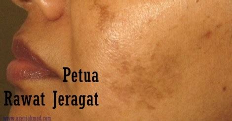 Beberapa orang di internet telah banyak memberikan review mengenai scrub yang satu ini. petua hilang jeragat Archives - azeniahmad.com