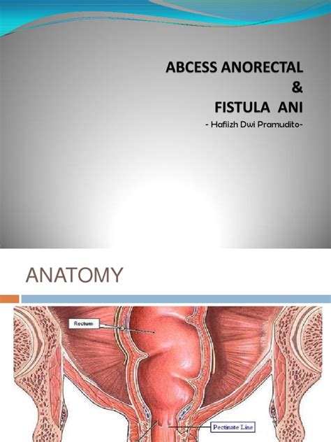 Meaning of fistula medical term. Fistula Perianal | Clinical Medicine | Medical Specialties