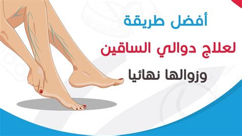 اعرف مضاعفات فشل علاج حالة الركبة الجحفاء. علاج دوالى ااساقين دكتور مازن السقا - Ø¹Ù„Ø§Ù…Ø§Øª Ø®Ù ÙŠØ ...