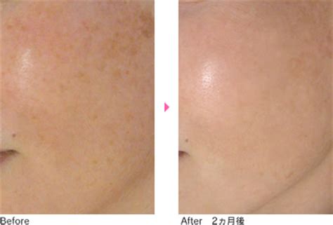 オバジ・ゼオスキンヘルス | ホームケア | さくらビューティ ...