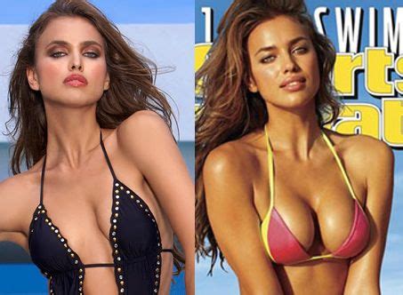 The peopletalk.ru periodical decided to clarify this with an expert. breast augmentation before and after | Irina Shayk Before ...