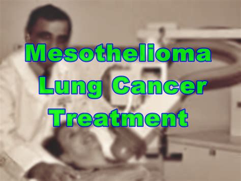 Doctor match program · 65 years of experience · help filing a claim Mesothelioma Lung Cancer Treatment