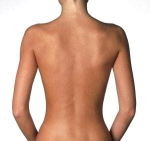 Find & download the most popular side body photos on freepik free for commercial use high quality images over 8 million stock photos. Back Liposuction / Smartlipo in Houston TX