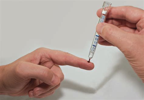 Der weltweit schnellste hiv heimtest. Hiv Test Zuhause