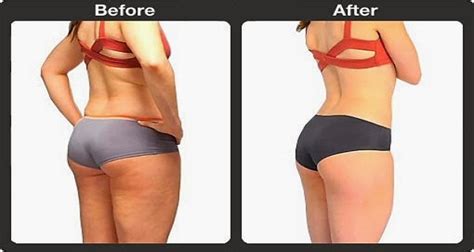 The last of these is especially pronounced. Brazilian Butt Lift 5-Minute Workout | Top Health Remedies