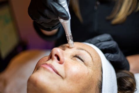 For a 0.5 mm roller, limit your use to one to three times per week. How Often to Microneedle in Wheaton | Wheaton | Images Med Spa