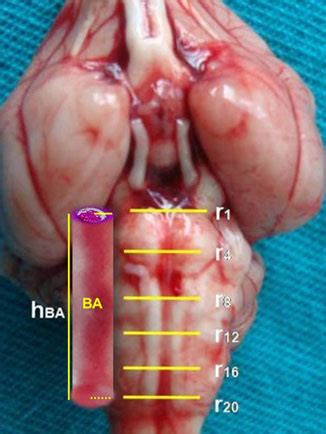 A venn diagram is used to show similarities and differences. All basilar arteries were viewed as a cylinder and simple ...