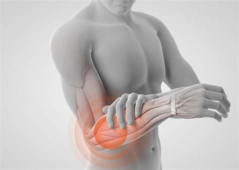 Kinésithérapeute du Sport : Tendinopathie