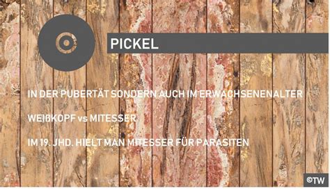 Vom aussehen her ähnelt es ein kleines bisschen einem riesenpickel. DoktorWeigl erklärt Pickel im Gesicht, auf dem Po ...