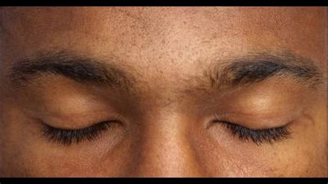 Moreover, an irritated scalp does not support healthy hair growth. Main Reasons For Thinning Eye Brow Hair - YouTube