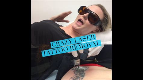 Most tattoos require multiple treatments to achieve complete removal, and each treatment is typically spaced at least 6 weeks apart. How Laser Tattoo Removal Works + My Experience - YouTube