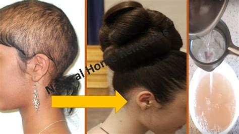 The ingredients you will use to make this remedy are yogurt, coconut oil, olive oil, egg and coffee powder. ⭐AWARDED BEST HAIR GROWTH REMEDY TO GROW HAIR IN 4 WEEKS ...