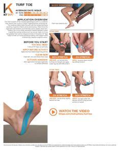 Turf toe, a sprain of the metatarsophalangeal joint, is a condition that results from acute or chronic hyperextension of the big toe. KT Bunion Taping: Tape provides a mechanical correction ...